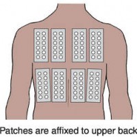 patch testing illustration