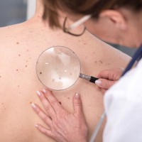 Can Skin Conditions Help You in Detecting an Illness? Advice from Expert Dermatologist Clinic, Harley Street Dermatology Clinic.