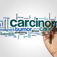 Basal Cell Carcinoma word cloud