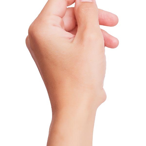 Cyst on the hand | Harley Street Dermatology Clinic