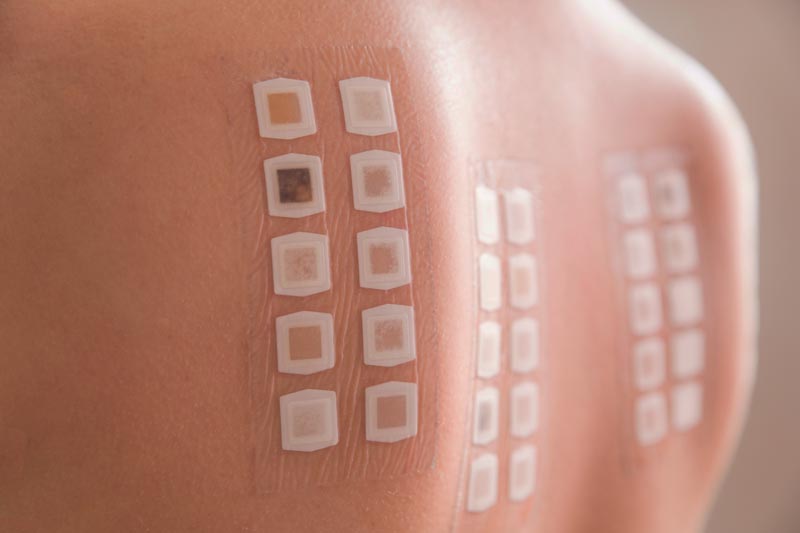 Patch Skin Test | Skin Allergies & Condition Treatment | Harley Street Dermatology Clinic | Expert Dermatologists in London