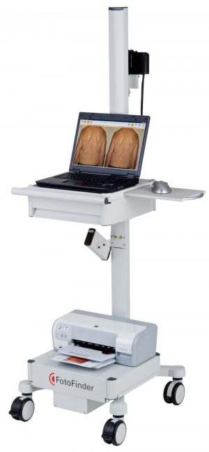 Image of Fotofinder machine for mole mapping | Harley Street Dermatology Clinic