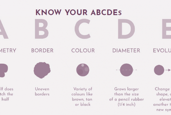 ABCDE Moles Chart | Harley Street Dermatology Clinic