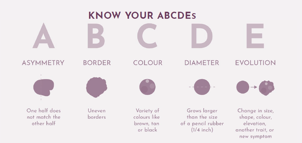 ABCDE Moles Chart | Harley Street Dermatology Clinic