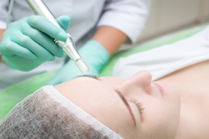 Microneedling for skin | Harley Street Dermatology Clinic