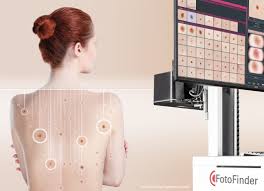 Image of Fotofinder mapping moles on a woman's back | Harley Street Dermatology Clinic