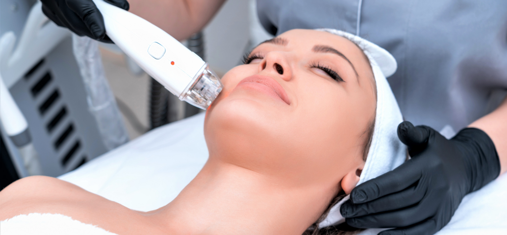 Does laser acne scar removal hurt?