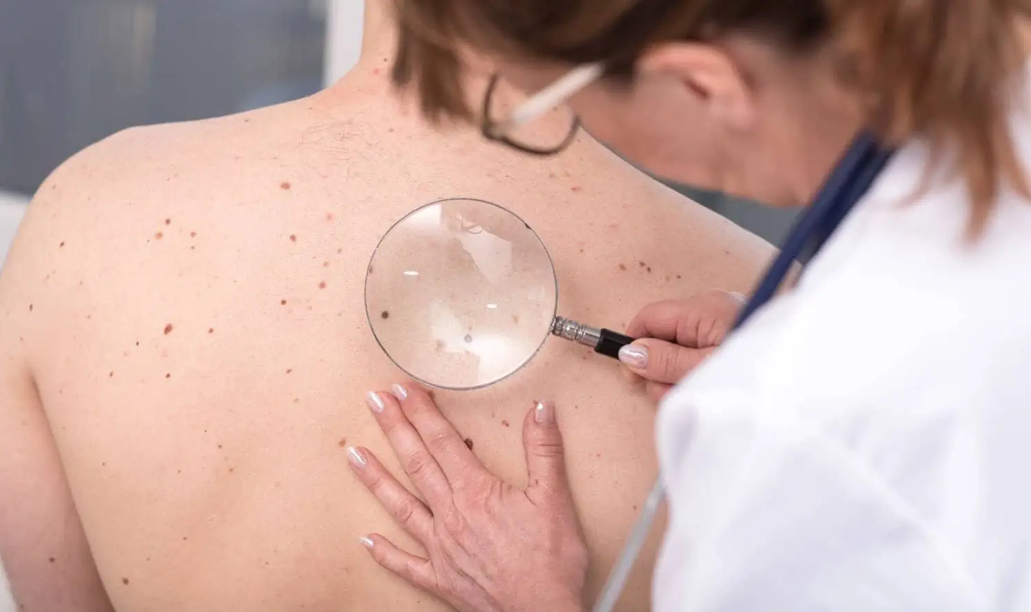 Can Skin Conditions Help You Detect an Illness?
