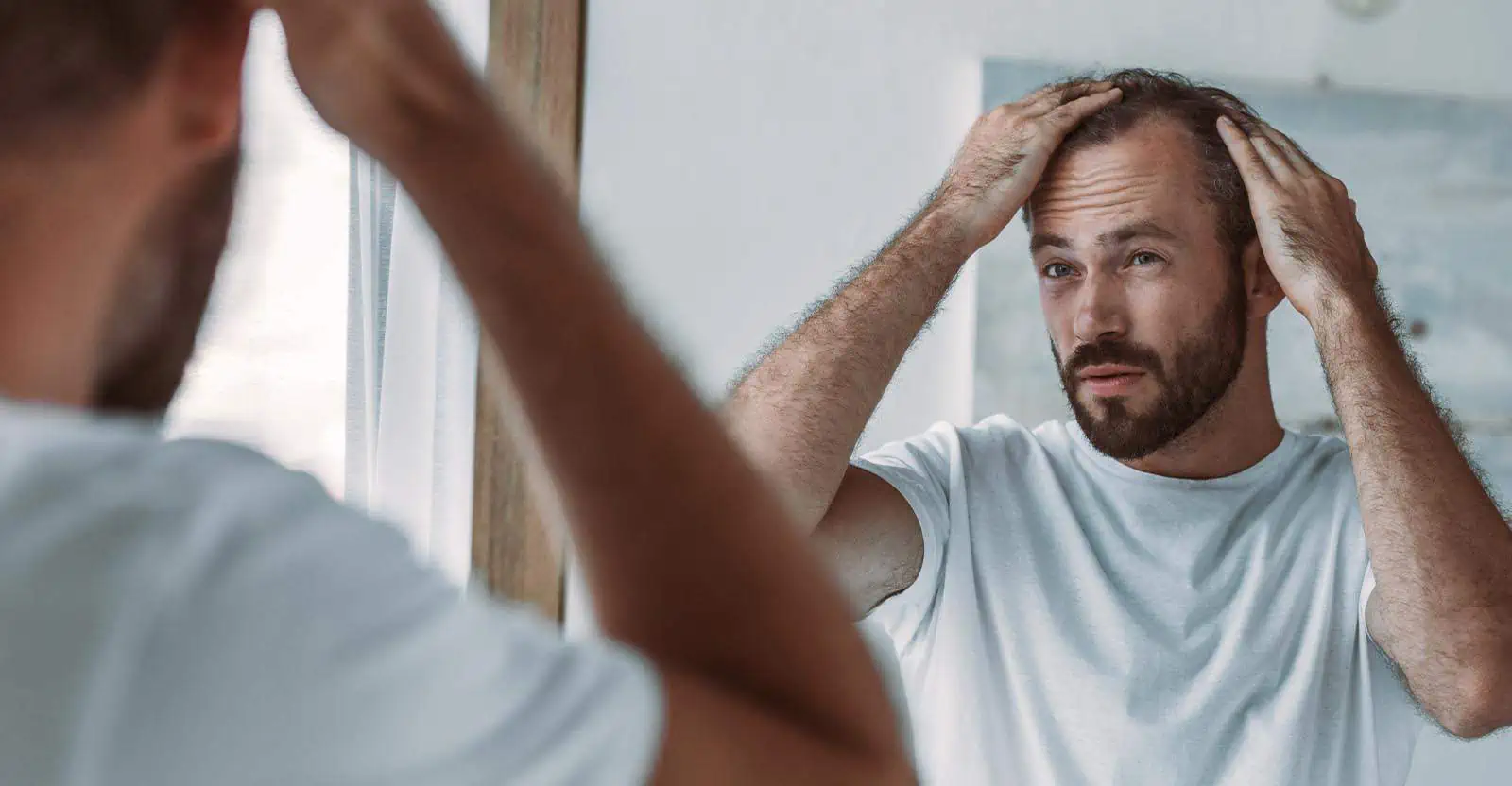 Why Does Alopecia Happen?