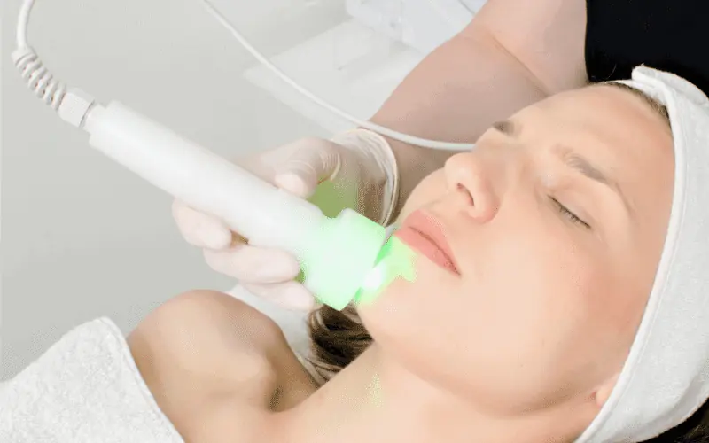 Does laser treatment reduce acne?